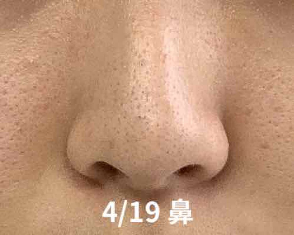 ゼロ毛穴パッド/MEDICUBE/ブースター・導入液を使ったクチコミ（3枚目）