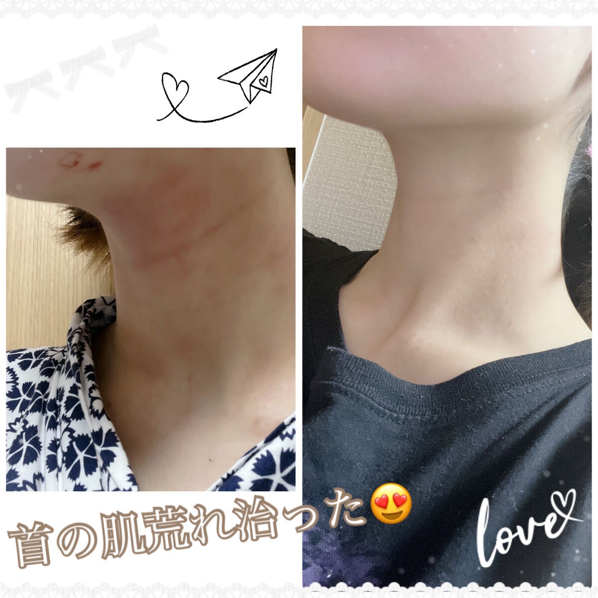 フォトシャイン/YA-MAN TOKYO JAPAN/美顔器・マッサージを使ったクチコミ(1枚目)