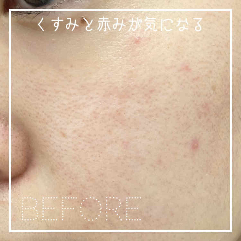 クリアウェルネス リファイニング ミルク/雪肌精/乳液を使ったクチコミ（2枚目）