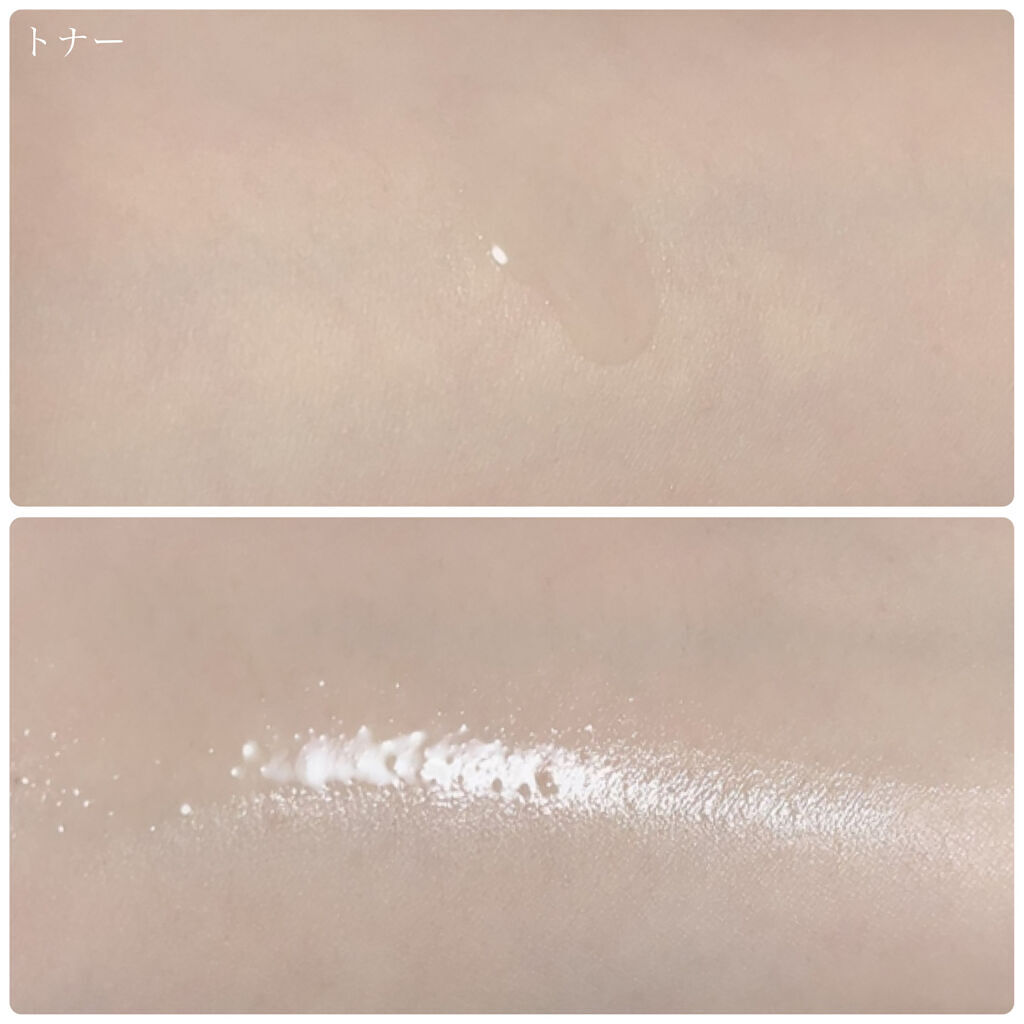 スーパーシカトナー/MEDICUBE/化粧水を使ったクチコミ（3枚目）