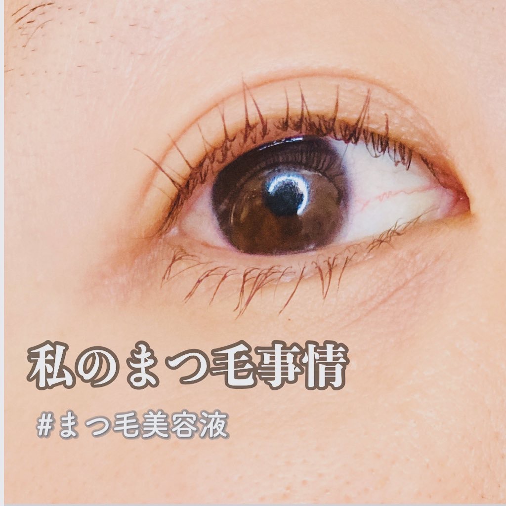 アイパワーセラム/グラングレイ/その他スキンケアを使ったクチコミ（1枚目）