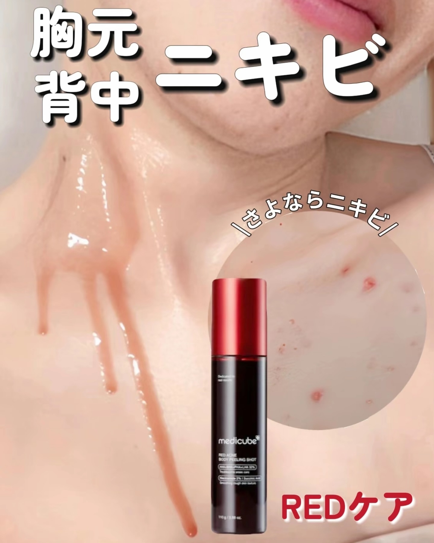 レッドアクネ ボディピーリングショット/MEDICUBE/ピーリングを使ったクチコミ（1枚目）