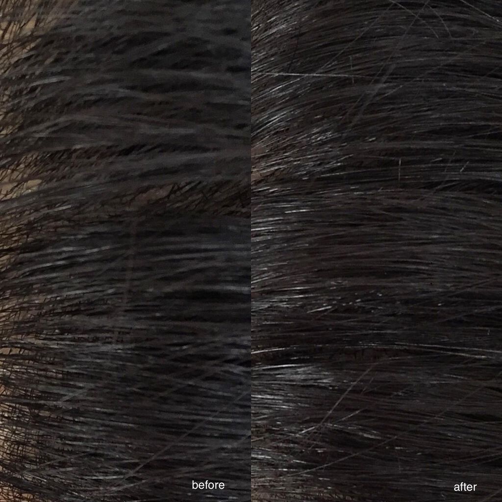 ベルタ ヘアローション/BELTA(ベルタ)/頭皮ローションを使ったクチコミ（1枚目）