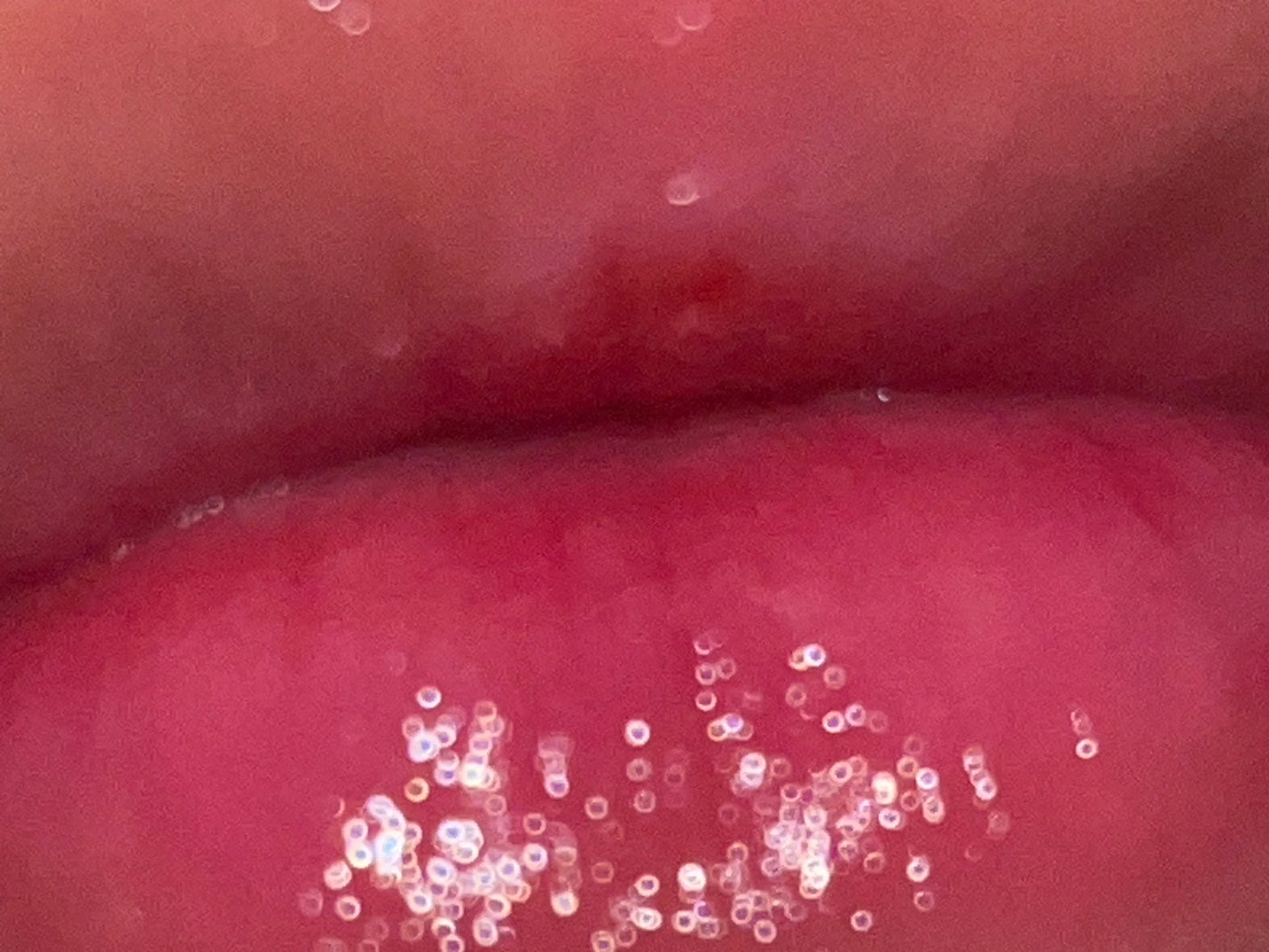 ð®ðªð ð on LIPS ãäœçªç®ãæ°ã«ãªããïŒ..ãïŒ5æç®ïŒ