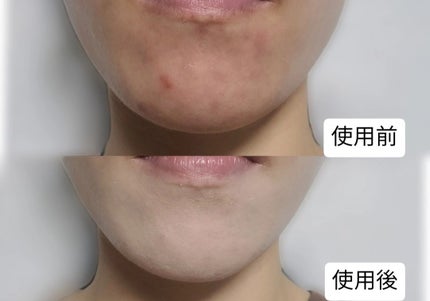 エスポア ビーグロー ボリュームクッション/espoir/クッションファンデーションを使ったクチコミ(4枚目)