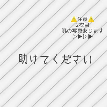 ハトムギ化粧水(ナチュリエ スキンコンディショナー R )/ナチュリエ/化粧水を使ったクチコミ（1枚目）