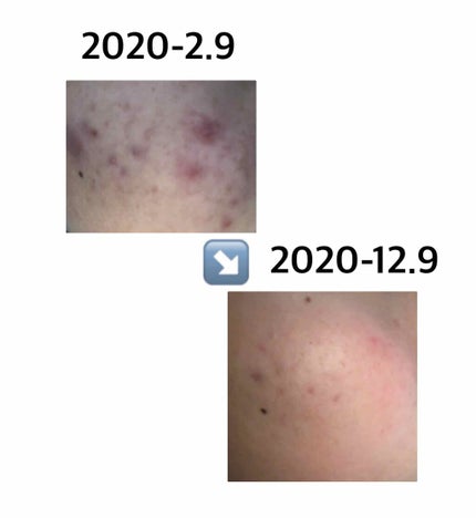 を使ったクチコミ(2枚目)