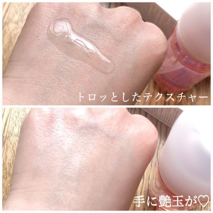 モイストケア ローション MB/d プログラム/化粧水を使ったクチコミ(2枚目)