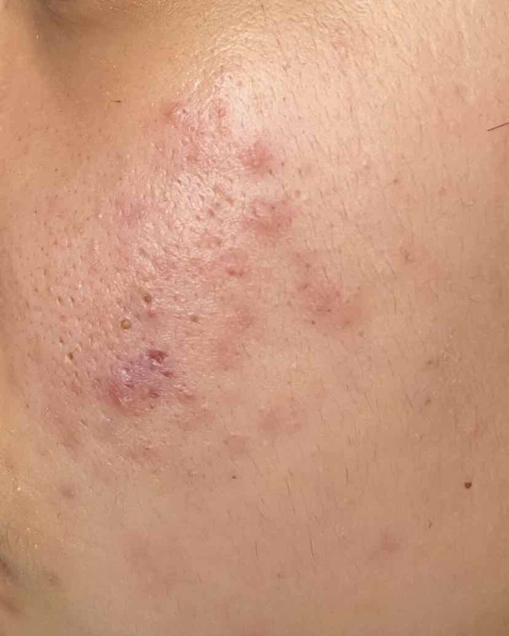 化粧水・敏感肌用・高保湿タイプ/無印良品/化粧水を使ったクチコミ（2枚目）