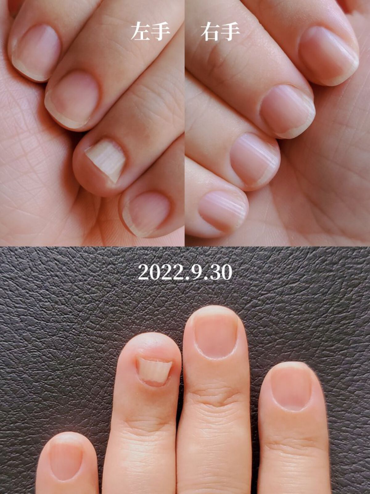 アンティセプト/LCN/ネイルオイル・トリートメントを使ったクチコミ（2枚目）