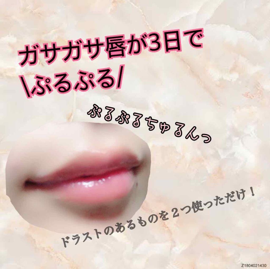 バイオイル/バイオイル/フェイスオイルを使ったクチコミ（1枚目）