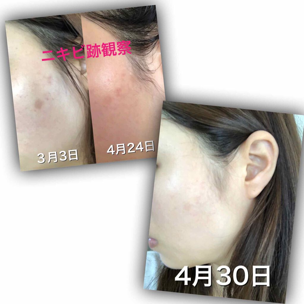 ハトムギ化粧水(ナチュリエ スキンコンディショナー R )/ナチュリエ/化粧水を使ったクチコミ（2枚目）