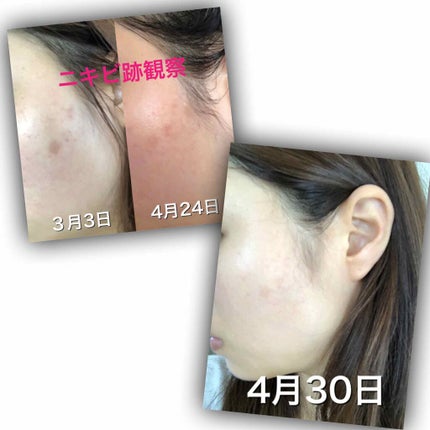 敏感肌用薬用美白乳液/無印良品/乳液を使ったクチコミ(2枚目)