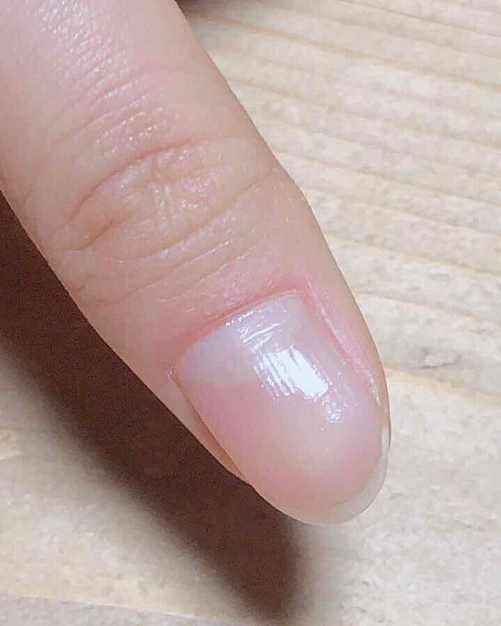 ネイルサポート ピンク/ネイルネイル/ネイルベースコートを使ったクチコミ（3枚目）