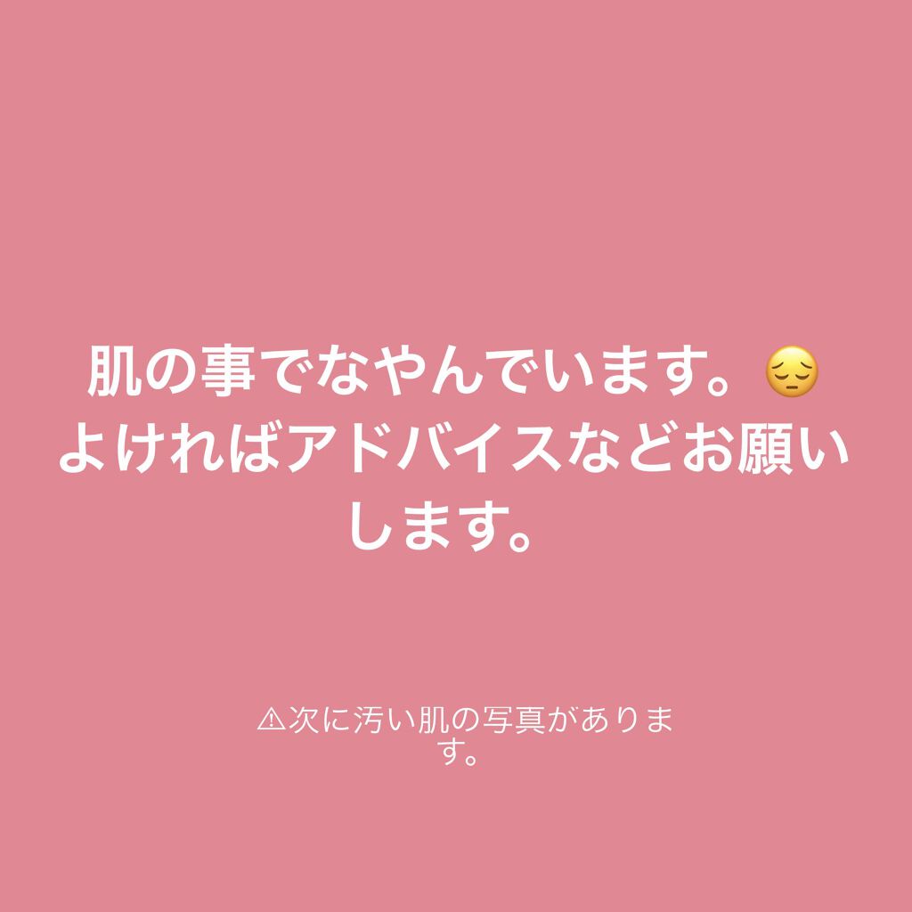 ハトムギ化粧水(ナチュリエ スキンコンディショナー R )/ナチュリエ/化粧水を使ったクチコミ（1枚目）