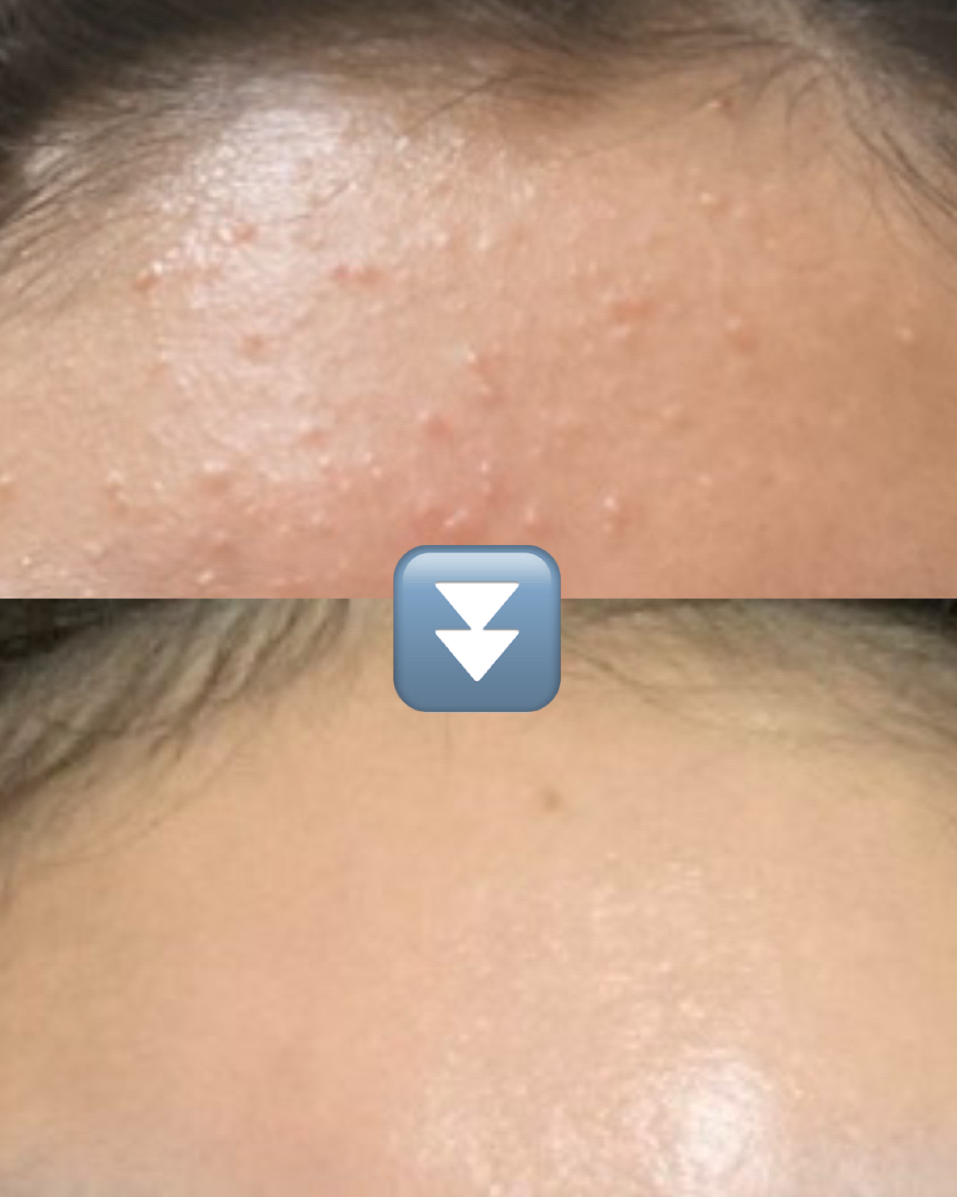 皮脂トラブルケア 化粧水/キュレル/化粧水を使ったクチコミ（1枚目）