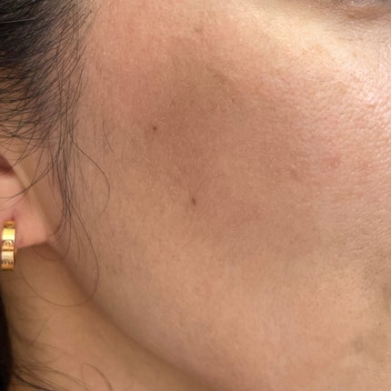 カバーアッププロコンシーラー/TFIT/パレットコンシーラーを使ったクチコミ(5枚目)