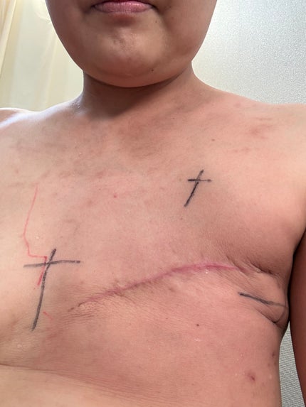 ベタメタゾン吉草酸エステル/イワキ/その他を使ったクチコミ(3枚目)