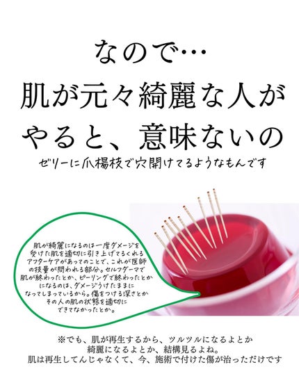 おゆみ|ニキビ・ニキビ跡ケア on LIPS 「@______ohyoume◀︎他の投稿はこちらから💄【レーザ..」(5枚目)
