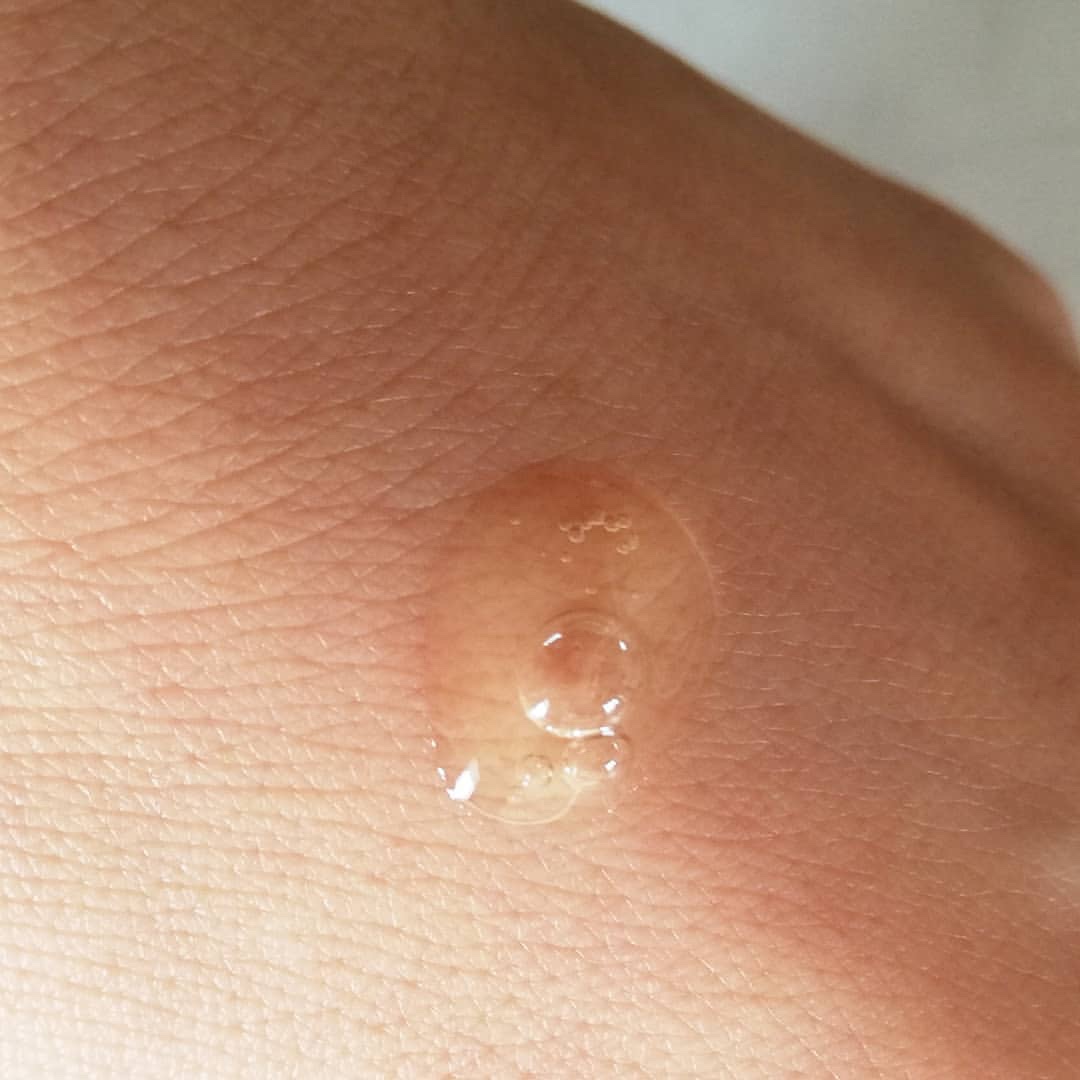 ハニープロポリスアンプル/HOLIKA HOLIKA/美容液を使ったクチコミ（3枚目）