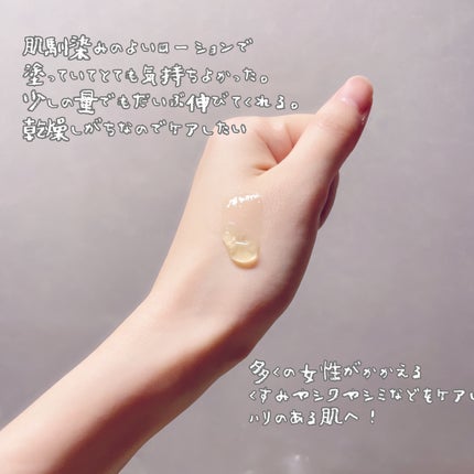 レチノールローション/APLIN/化粧水を使ったクチコミ(3枚目)