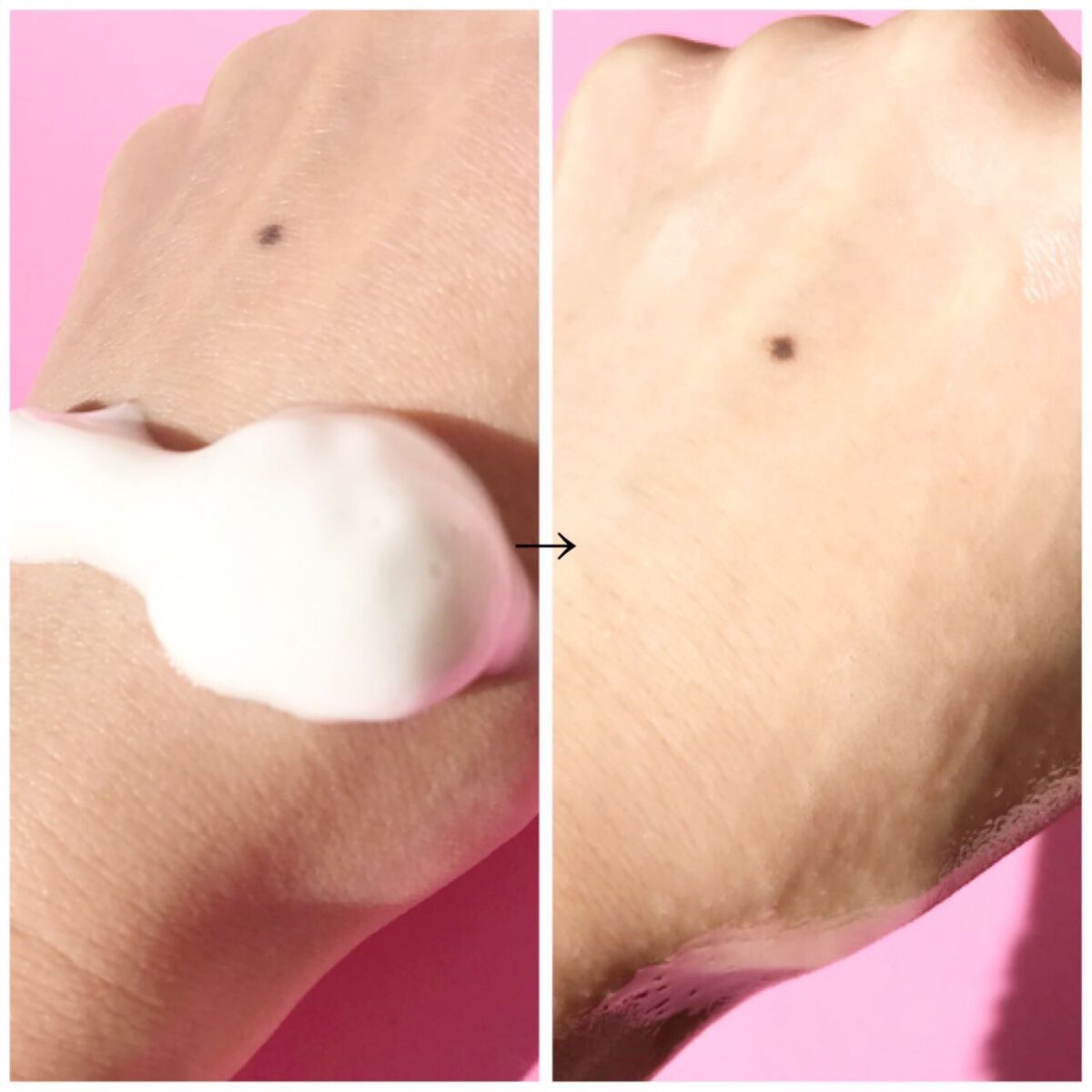 シュワとろオイル泡クレンジング/ビフェスタ/オイルクレンジングを使ったクチコミ(2枚目)