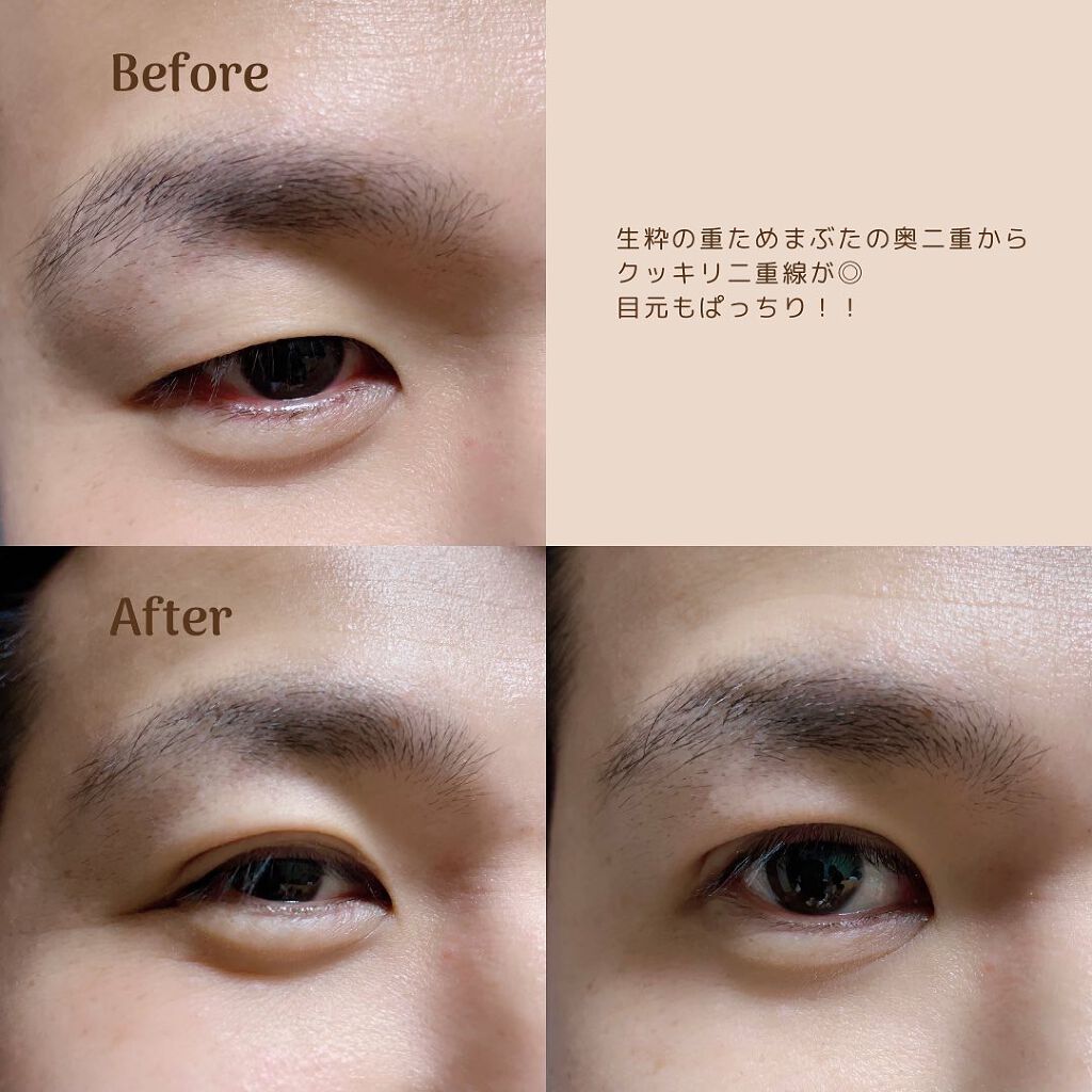 メザイク クリップ カッター ファイバー専用カッター/メザイク/二重まぶた用アイテムを使ったクチコミ(3枚目)