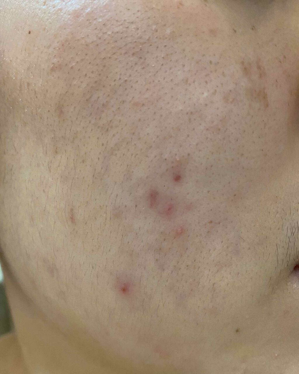 敏感肌用薬用美白美容液/無印良品/美容液を使ったクチコミ（2枚目）