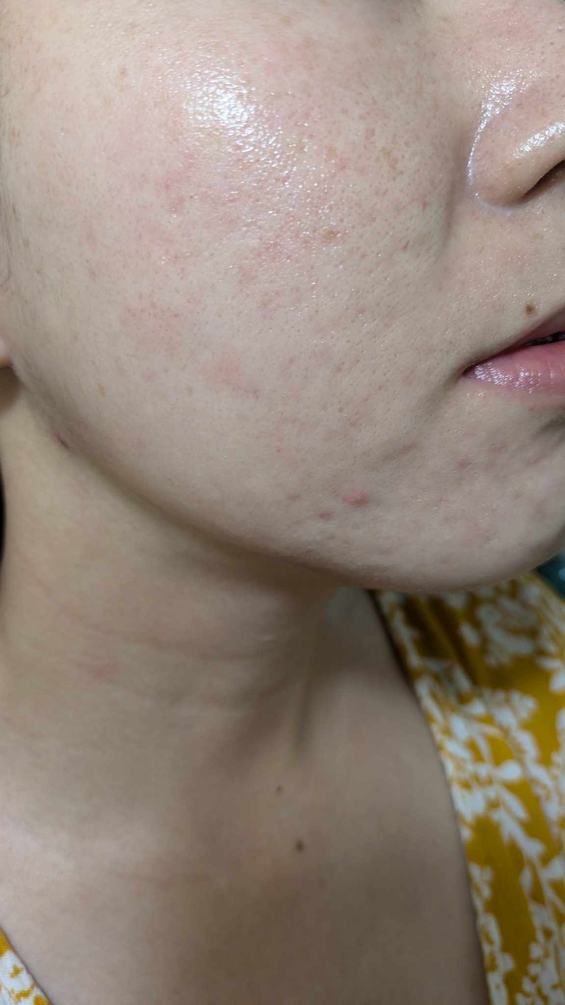 クリーム NC/なめらか本舗/フェイスクリームを使ったクチコミ（1枚目）