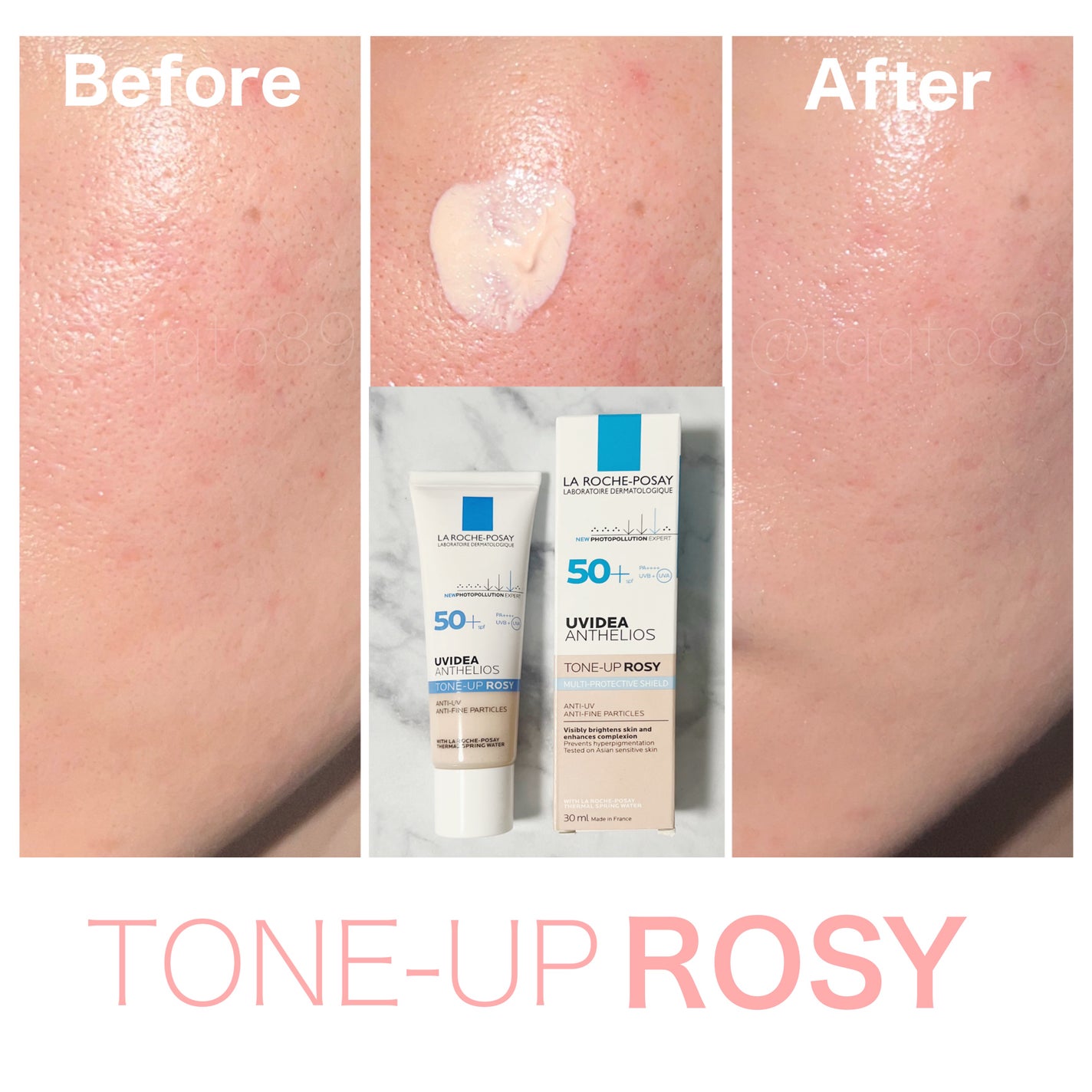 UVã€ã㢠XL ãããã¯ã·ã§ã³ããŒã³ã¢ãã ããŒãº/ã© ããã·ã¥ ããŒ/æ¥çŒãæ¢ãã¯ãªãŒã ã䜿ã£ãã¯ãã³ãïŒ2æç®ïŒ