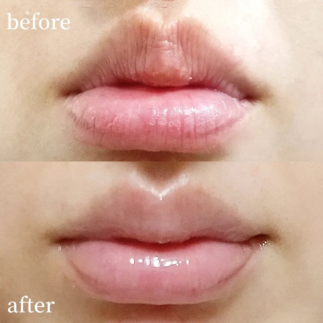 メンソレータム リペアワン 角質ケアリップ/メンソレータム/リップクリームを使ったクチコミ（3枚目）