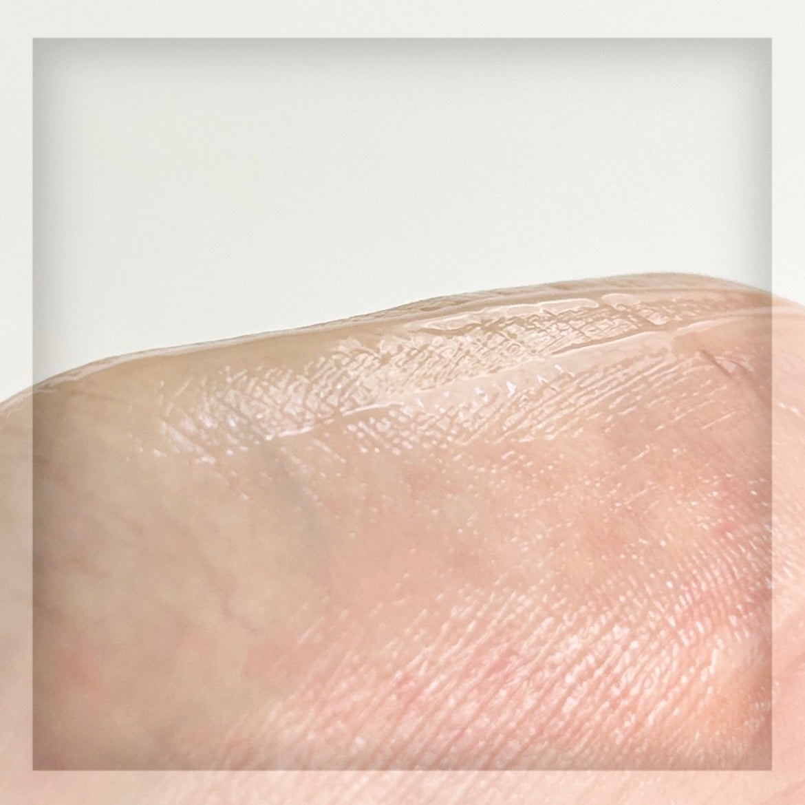 ブレミッシュケアアップ セラム/ISOI/美容液を使ったクチコミ(5枚目)