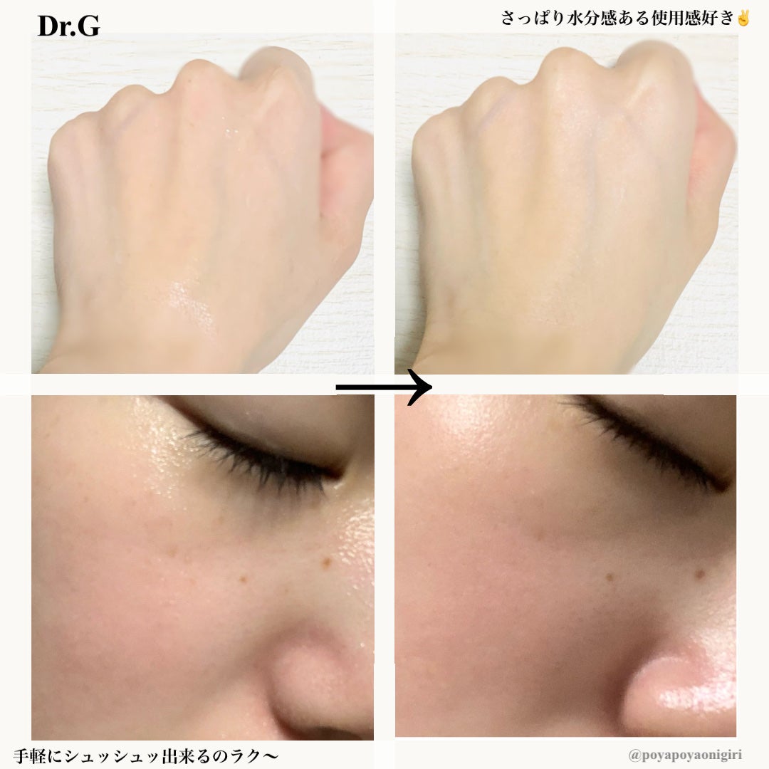 ドクタージー ブラックスネイル コラーゲンミスト/Dr.G/ミスト状化粧水を使ったクチコミ(3枚目)