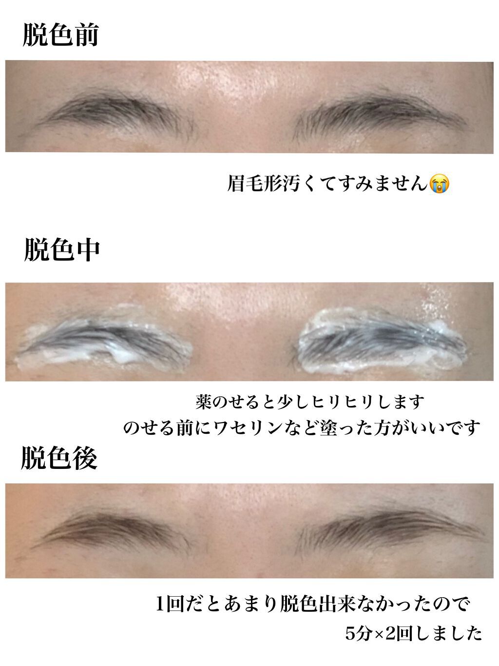 脱色クリーム スピーディー/エピラット/ムダ毛ケアを使ったクチコミ（2枚目）