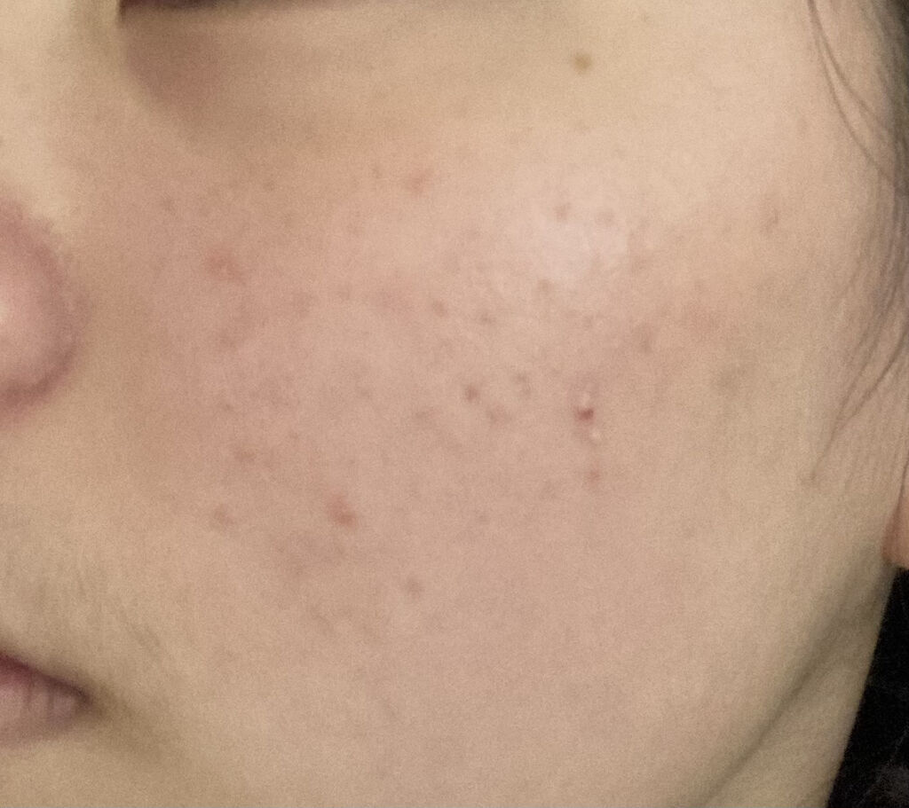 ハトムギ化粧水(ナチュリエ スキンコンディショナー R )/ナチュリエ/化粧水を使ったクチコミ（3枚目）