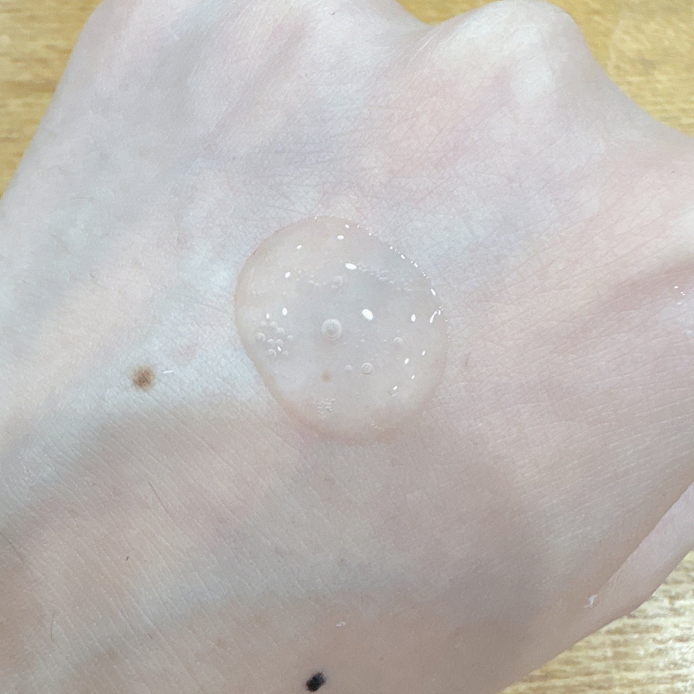 ドクダミテンダーゾームダブルカーミング水分アンプル/ilso/美容液を使ったクチコミ(9枚目)