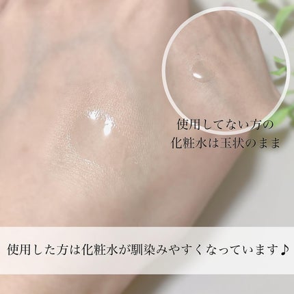 薬用ファーストエッセンス/ALBLANC/ブースター・導入液を使ったクチコミ(4枚目)