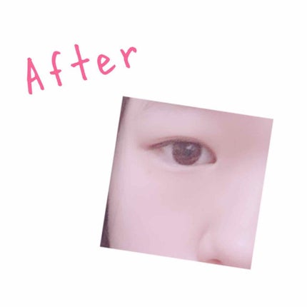 アイテープ 埋没式両面テープ/DAISO/二重まぶた用アイテムを使ったクチコミ(4枚目)