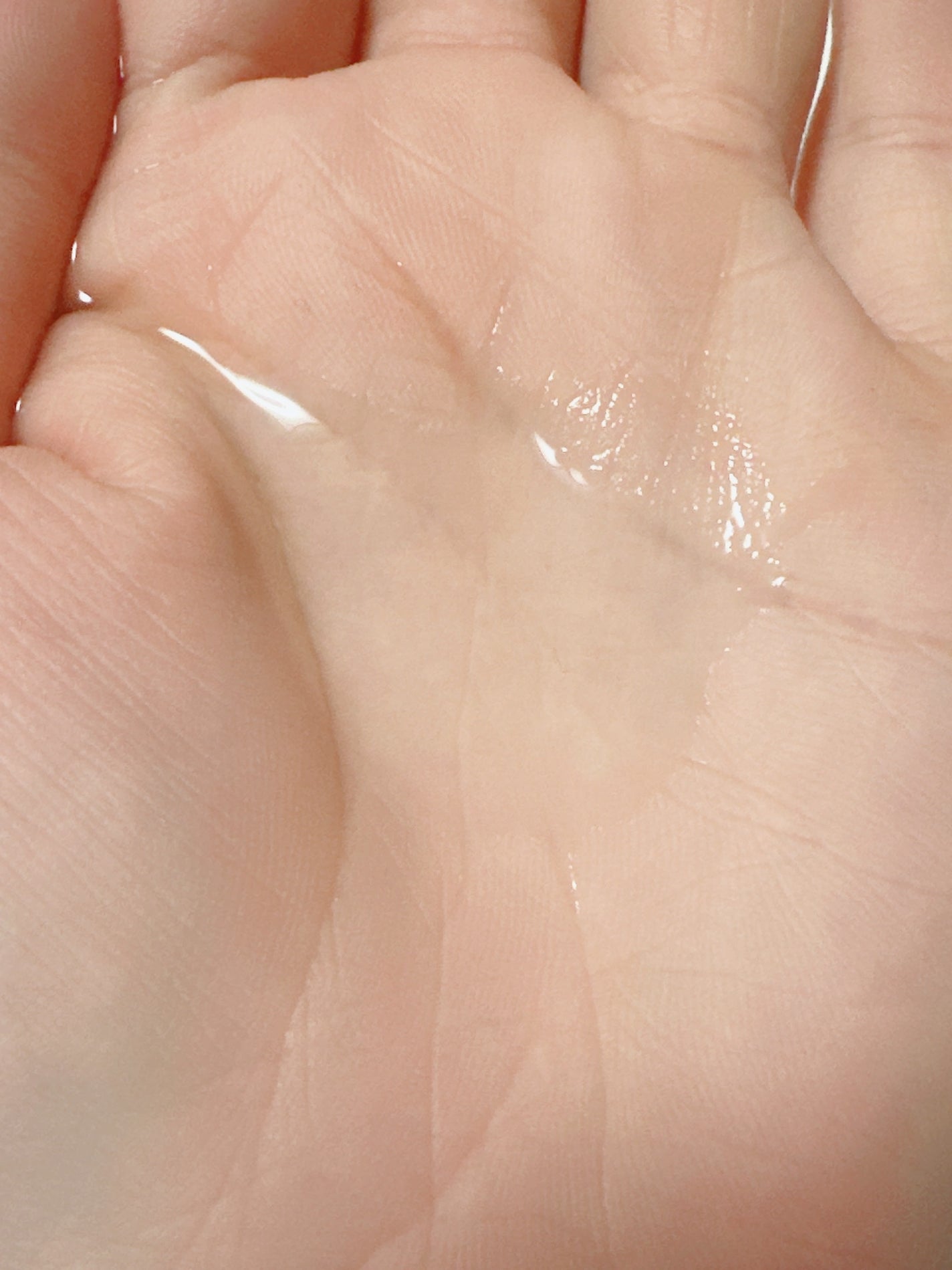 VC100エッセンスローション EX/ドクターシーラボⓇ/化粧水を使ったクチコミ(3枚目)