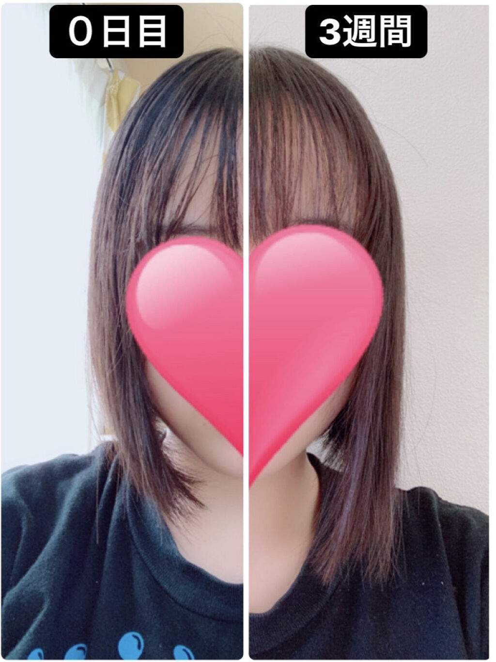 ヘアアクセルレーター フローラルの香り/加美乃素本舗/頭皮ローションを使ったクチコミ（1枚目）