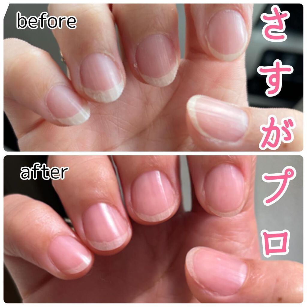 ぴむら ぴぐらび on LIPS 「爪ケア始めました!╰(*´︶`*)╯♡♡♡♡♡♡♡♡♡♡以前ジ..」(5枚目)