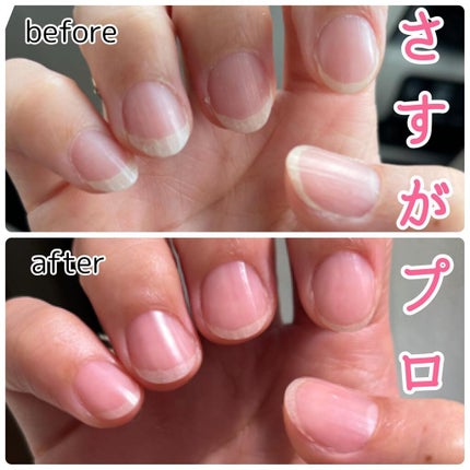 ぴむら ぴぐらび on LIPS 「爪ケア始めました!╰(*´︶`*)╯♡♡♡♡♡♡♡♡♡♡以前ジ..」(5枚目)