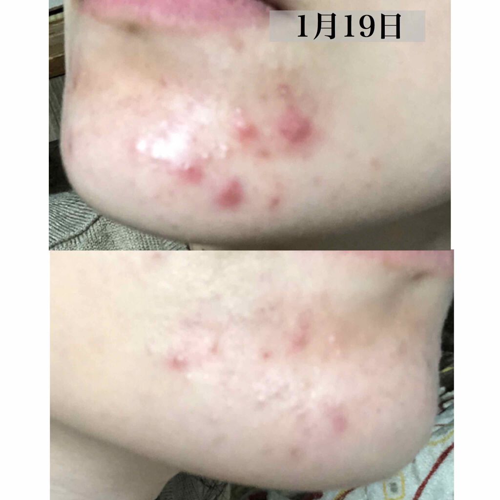 ディアナチュラスタイル ヘム鉄×葉酸+ビタミンB6・B12・C/Dear-Natura (ディアナチュラ)/食品を使ったクチコミ(3枚目)