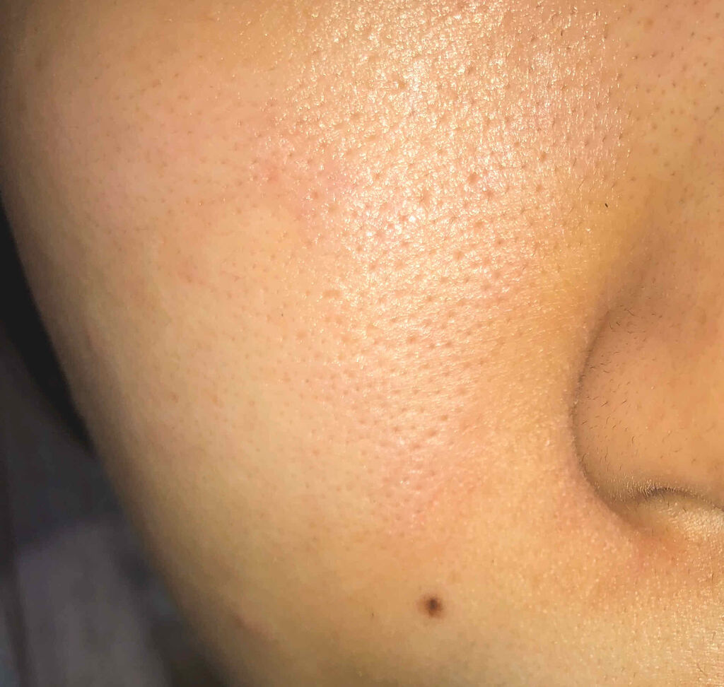 ホワイトアップ ローション(II)/アクアレーベル/化粧水を使ったクチコミ（2枚目）