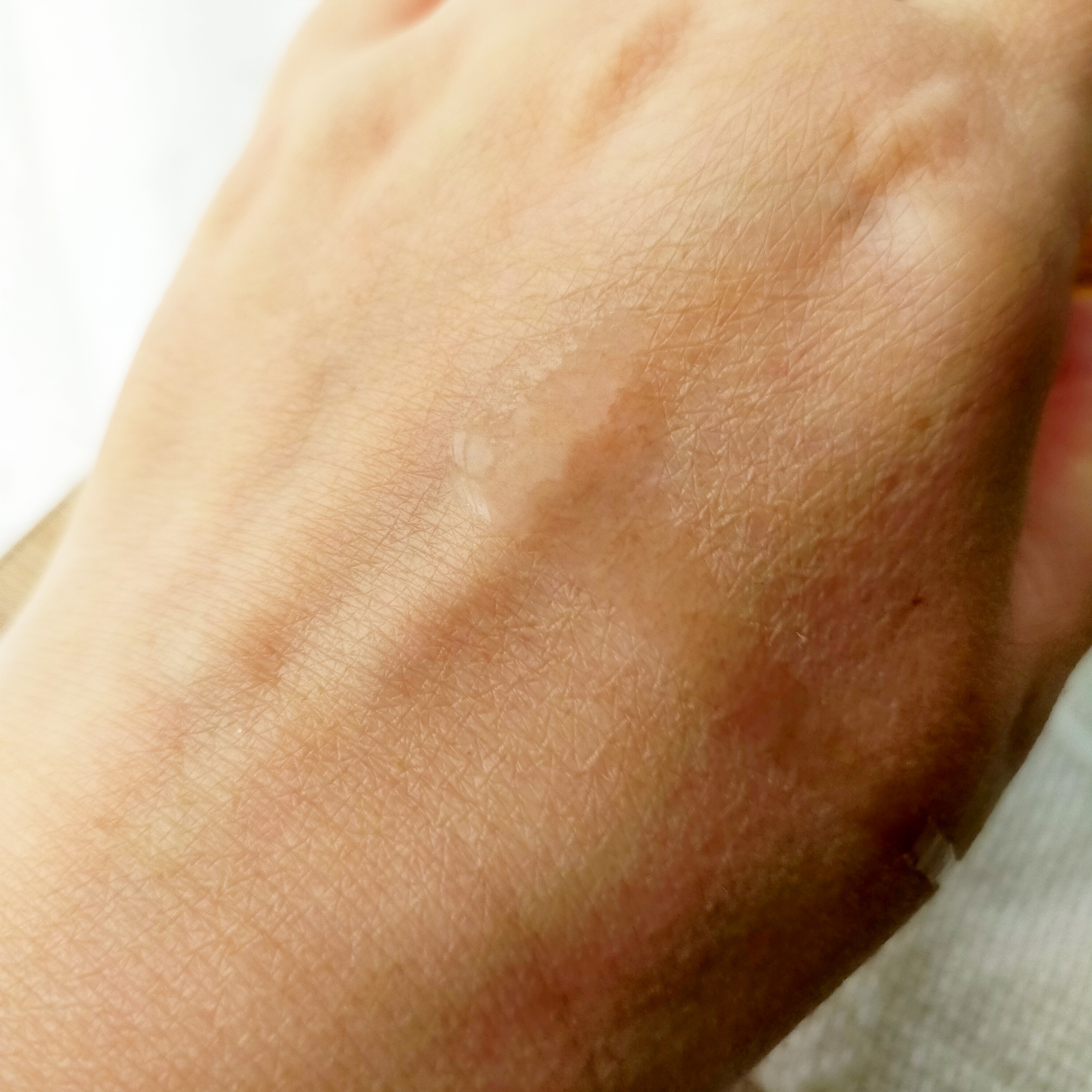 インテンスケアガラクトミセスファーストエッセンス /cos:mura/ブースター・導入液を使ったクチコミ（2枚目）