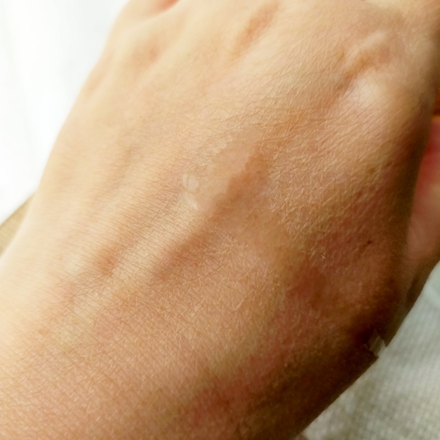 インテンスケアガラクトミセスファーストエッセンス /cos:mura/ブースター・導入液を使ったクチコミ(2枚目)