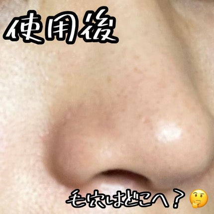 男の子用 シートマスク/毛穴撫子/シートマスク・パックを使ったクチコミ(3枚目)