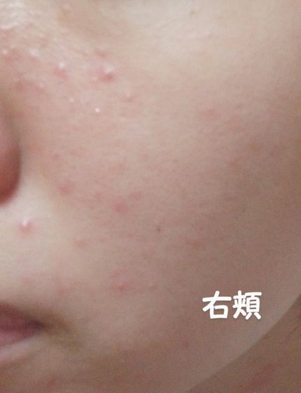 ソフティモ ディープ クレンジングオイル/ソフティモ/オイルクレンジングを使ったクチコミ(4枚目)