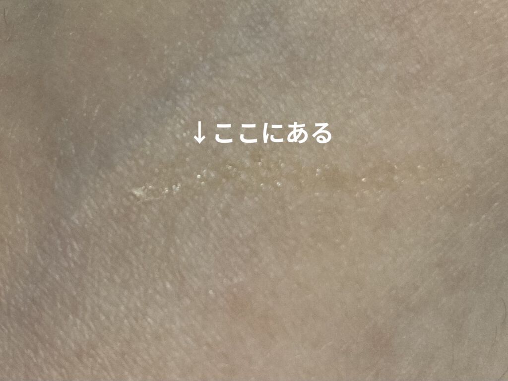 メッシュアイテープ/DAISO/二重まぶた用アイテムを使ったクチコミ（3枚目）