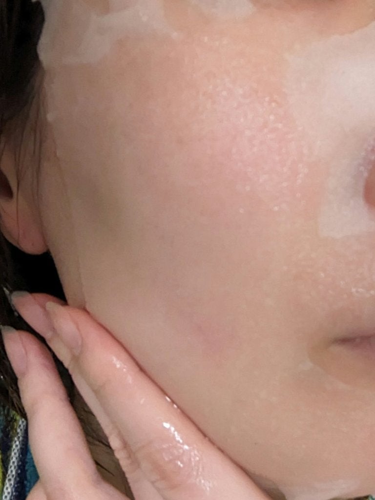 ダーマレーザー スーパー VC100 ホワイトマスク/クオリティファースト/シートマスク・パックを使ったクチコミ(5枚目)